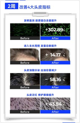 晶泰科技AI 研發平台開發的小分子Remeanagen™ 和多肽 AquaKine™聯用配方改善頭皮四大指標，有效固發防掉發